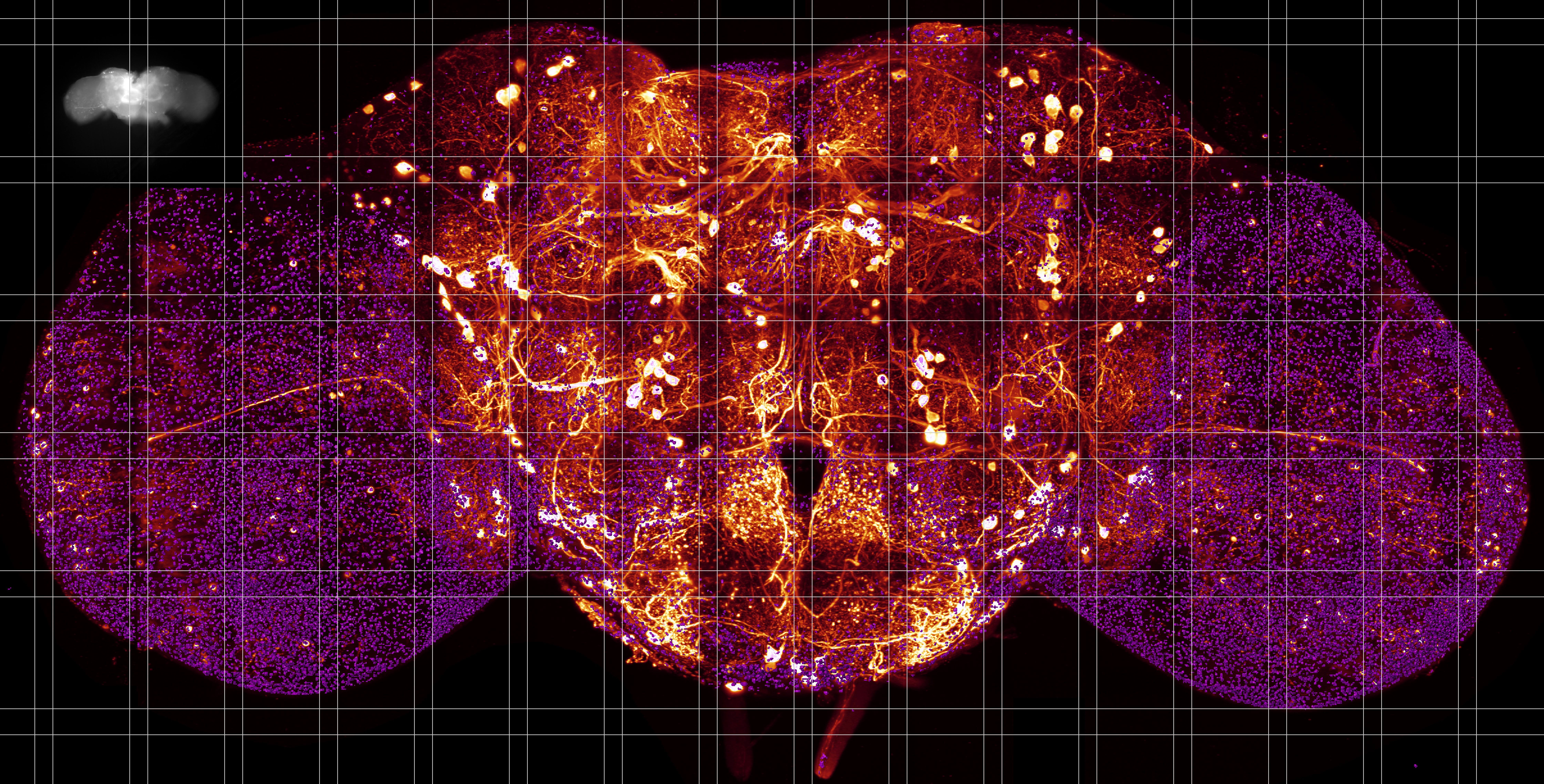 Expanded Brains, Nanoscale Views: A New Era in Neuroimaging