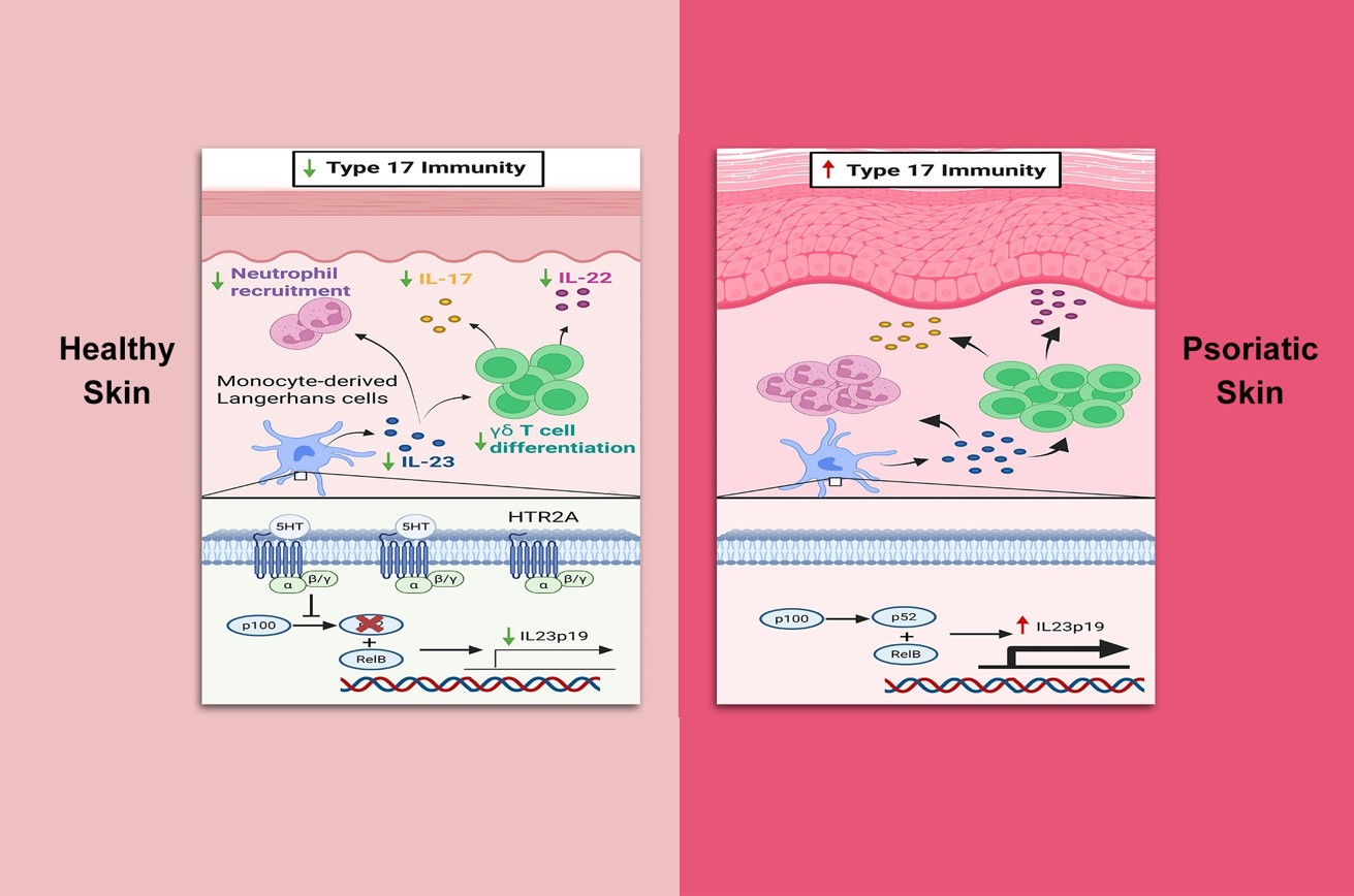New Mechanism Identified in Psoriasis: Serotonin 2A Receptor in Monocyte-derived Langerhans Cells Suppresses IL-23 Secretion