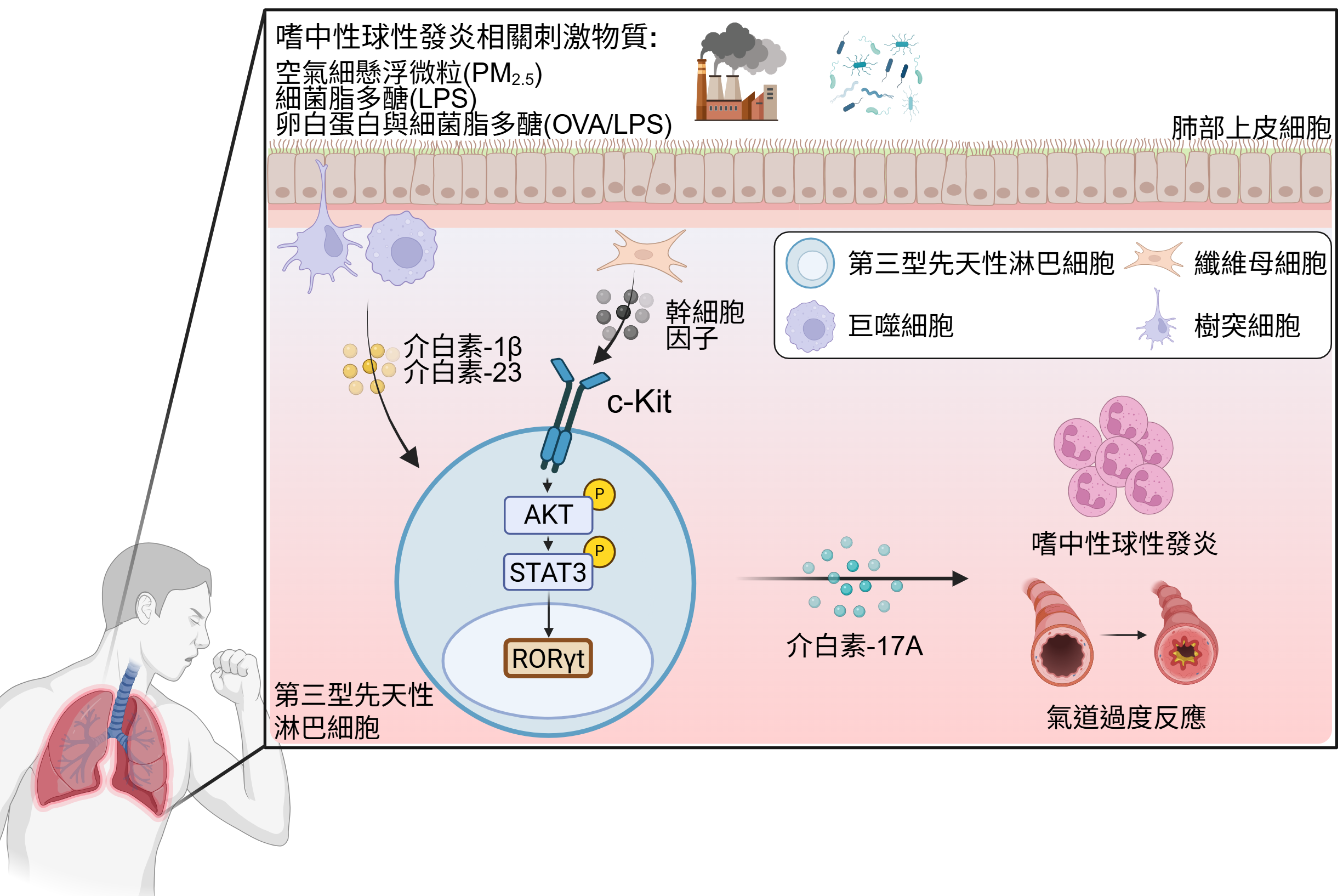New Mechanism Identified in Neutrophilic Asthma: SCF/c-Kit Signaling Drives ILC3-Mediated Inflammation