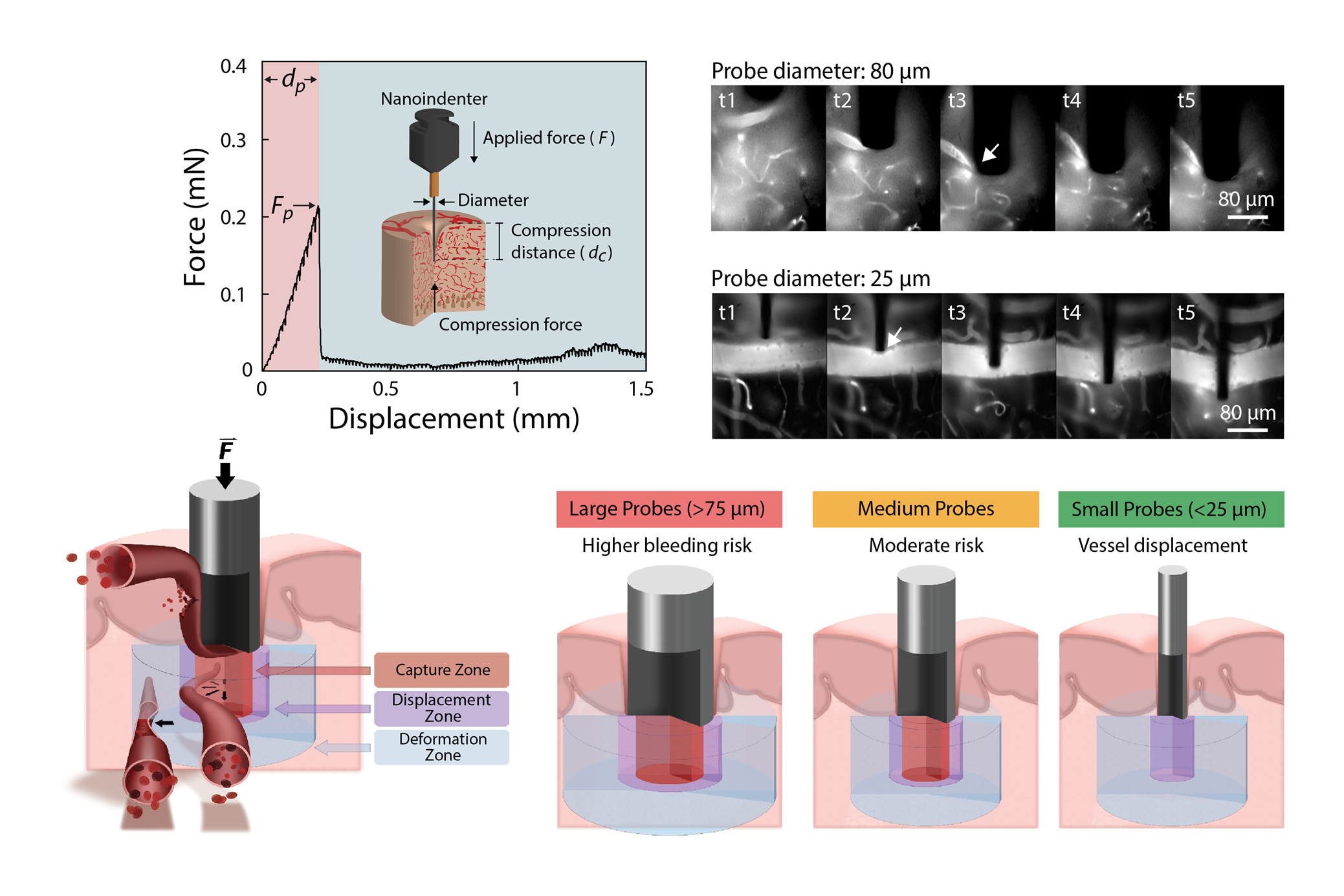 Ultrasmall brain probes reduce implantation damage and bleeding