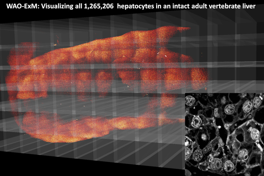 Visualizing every hepatocyte in an intact adult vertebrate liver