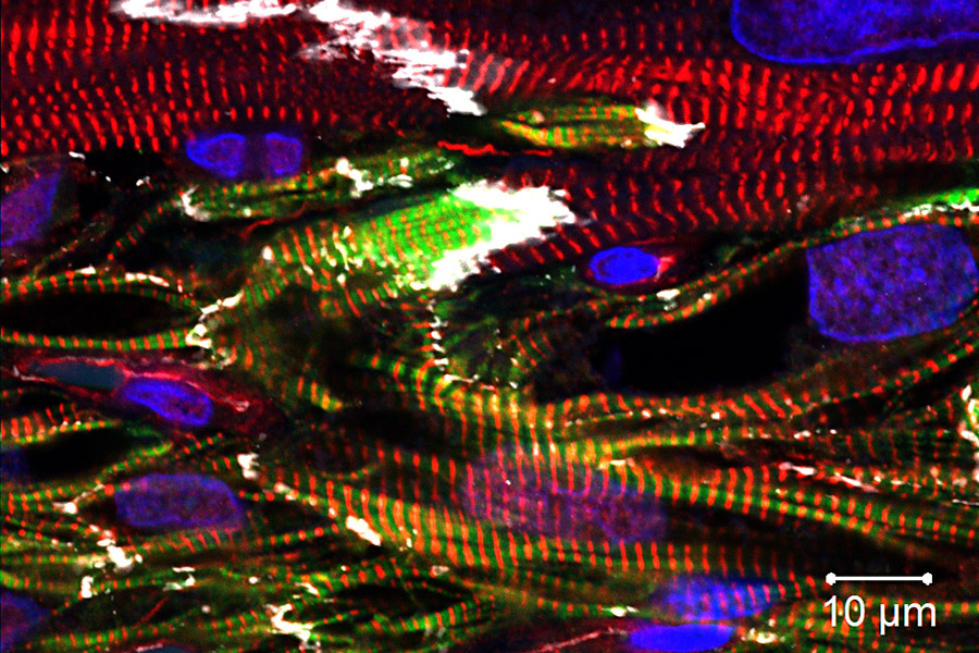 人類iPS幹細胞衍生的心肌細胞(綠色螢光標記人類蛋白與紅色螢光標記肌小節)能與猴子心肌細胞(紅色螢光標記肌小節)結合，達到心肌再生。