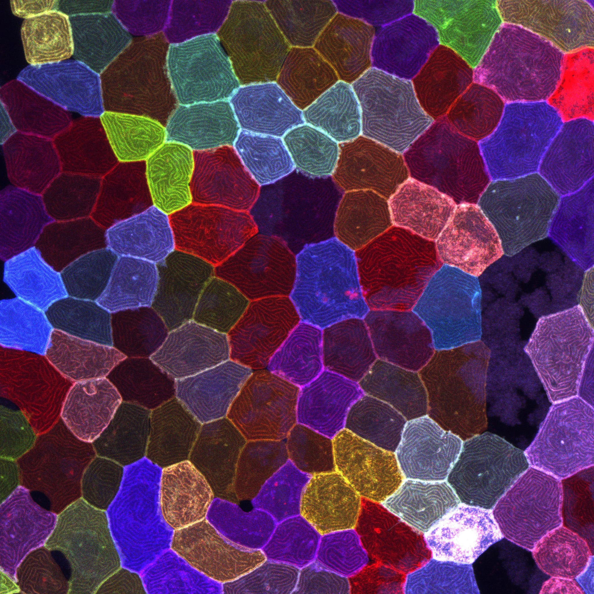 斑馬魚的皮膚細胞(B) Zebrafish Skin Cells (B)/陳潔盈 Keat Ying Chan/中央研究院細胞與個體生物學研究所 Institute of Cellular and Organismic Biology, Academia Sinica