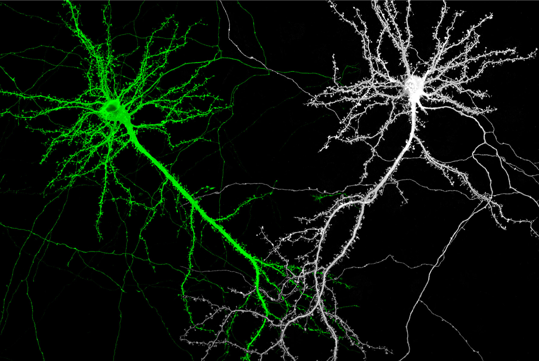 Counting Synapses in Neurons/Yi-Shuian Huang/ Institute of Biomedical Sciences, Academia Sinica