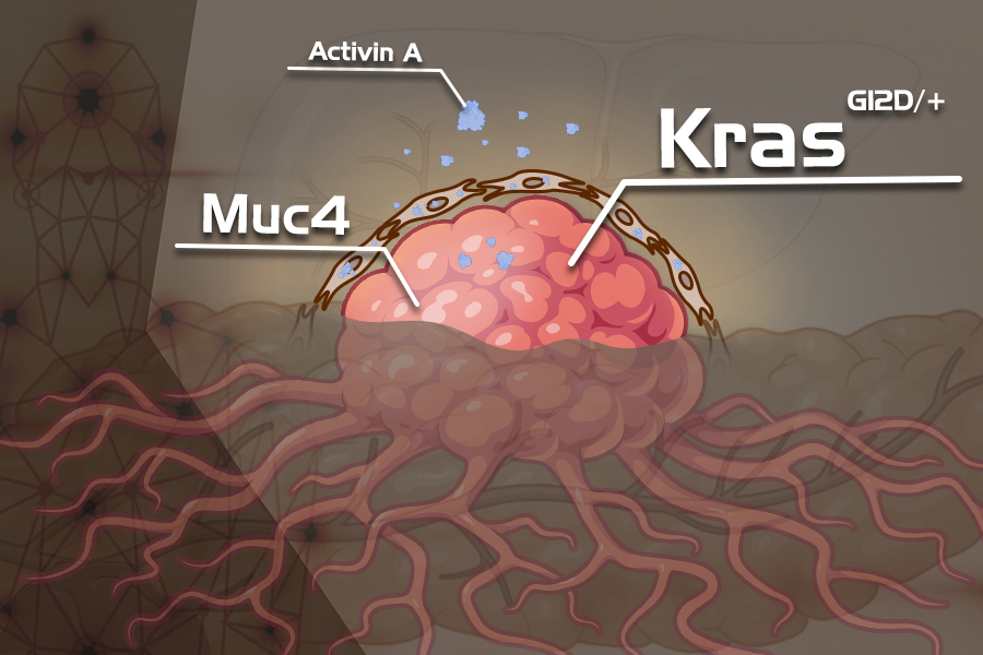 揭開致癌KRAS基因驅動胰臟癌前病變的神秘面紗