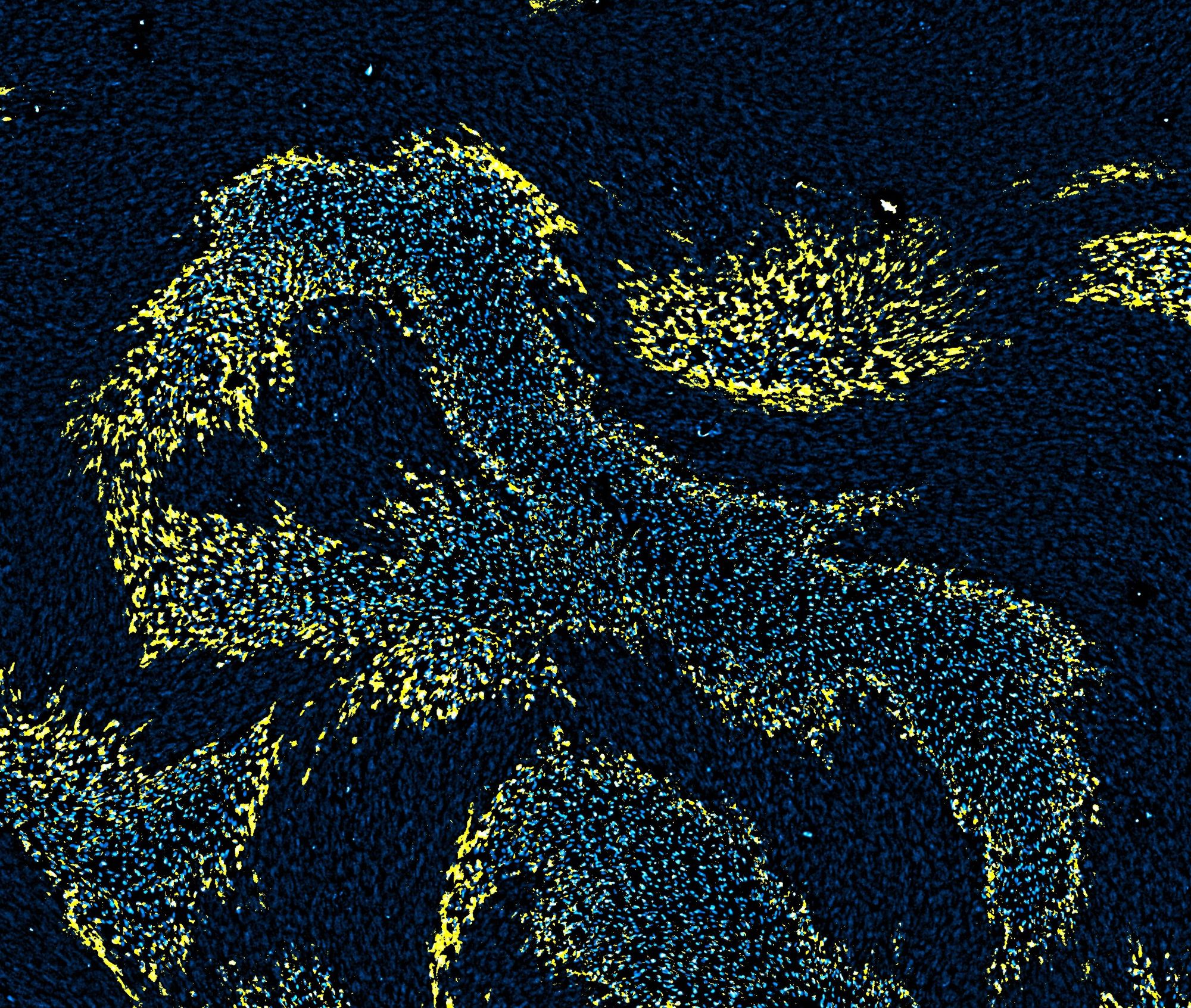 Lipid peroxidation wavefront (yellow) travels along cell alignment, guiding the directional spread of ferroptosis cell death (white). Photo credit: Academia Sinica.
